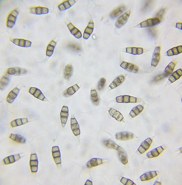 Esporas de Pestalotiopsis microspora.
